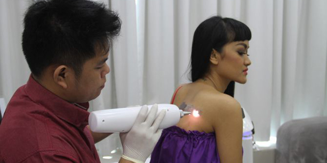 Jupe sedang menghapus tato di punggungnya. (Foto: BeritaPrima/ dok Jupe)
