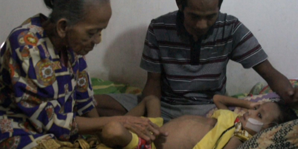 Bocah Penderita Tumor Ganas Tak Punya Biaya