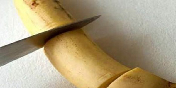 Istri Ini Tega Dua Kali Potong Alat Kelamin Suami